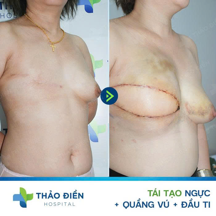 tai-tao-vu