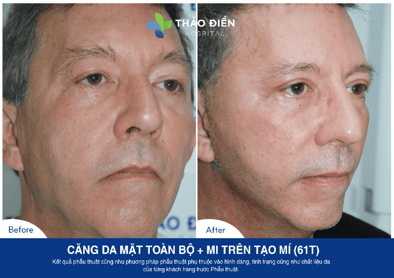 Gary Jarrett 61t CDM toan bo + Mi tren tao mi -1