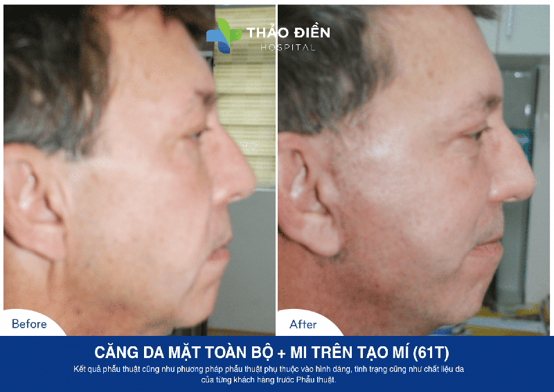 Gary Jarrett 61t CDM toan bo + Mi tren tao mi -2