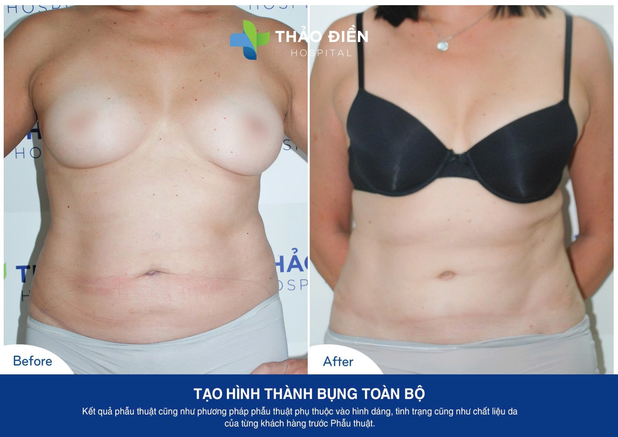 tao-hinh-thanh-bung